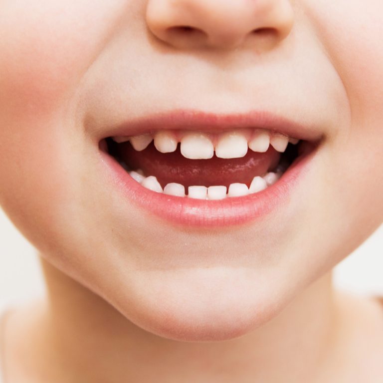 baby smile close. child teeth on a white isolated background.