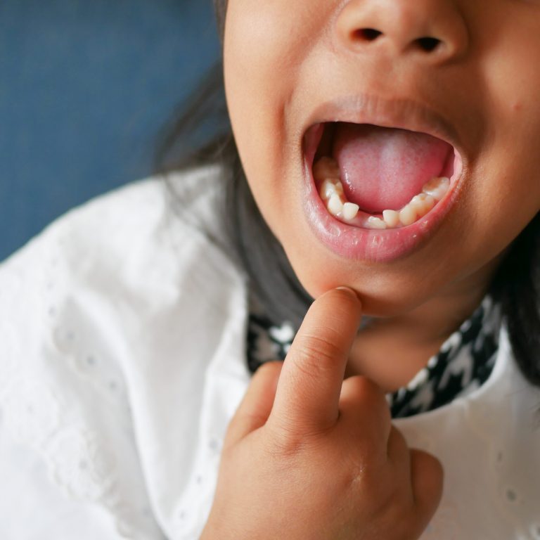 detail shot of child with teeth missing.