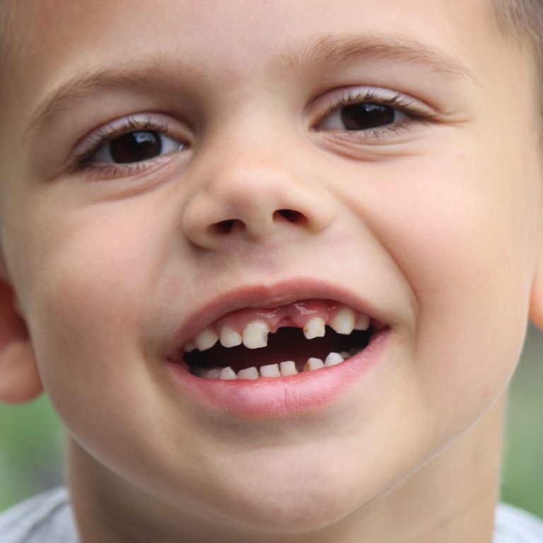 The child lost a tooth. Selective focus. Kid.Concept baby tooth